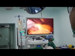 Bariatic Surgery